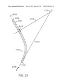 CURVED CANNULA INSTRUMENT diagram and image