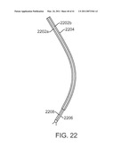 CURVED CANNULA INSTRUMENT diagram and image