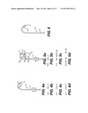 Suture Passing Devices and Methods diagram and image