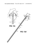 Suture Passing Devices and Methods diagram and image