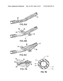 ARTICULATING SUTURING DEVICE AND METHOD diagram and image