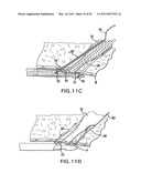 ARTICULATING SUTURING DEVICE AND METHOD diagram and image