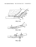 ARTICULATING SUTURING DEVICE AND METHOD diagram and image