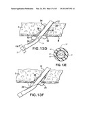 ARTICULATING SUTURING DEVICE AND METHOD diagram and image