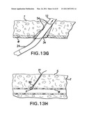 ARTICULATING SUTURING DEVICE AND METHOD diagram and image