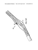 ARTICULATING SUTURING DEVICE AND METHOD diagram and image