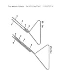 ARTICULATING SUTURING DEVICE AND METHOD diagram and image