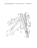 ARTICULATING SUTURING DEVICE AND METHOD diagram and image