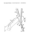 ARTICULATING SUTURING DEVICE AND METHOD diagram and image