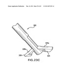 ARTICULATING SUTURING DEVICE AND METHOD diagram and image