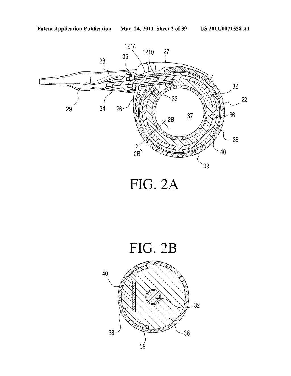 IMPLANTABLE RESTRICTION SYSTEM TENSION RELEASE MECHANISM - diagram, schematic, and image 03