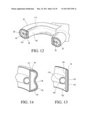 IMPLANTABLE RESTRICTION SYSTEM TENSION RELEASE MECHANISM diagram and image