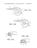 IMPLANTABLE RESTRICTION SYSTEM TENSION RELEASE MECHANISM diagram and image