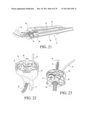 IMPLANTABLE RESTRICTION SYSTEM TENSION RELEASE MECHANISM diagram and image