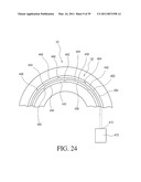 IMPLANTABLE RESTRICTION SYSTEM TENSION RELEASE MECHANISM diagram and image