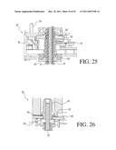 IMPLANTABLE RESTRICTION SYSTEM TENSION RELEASE MECHANISM diagram and image