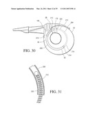 IMPLANTABLE RESTRICTION SYSTEM TENSION RELEASE MECHANISM diagram and image