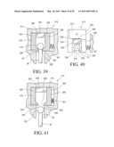 IMPLANTABLE RESTRICTION SYSTEM TENSION RELEASE MECHANISM diagram and image