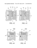 IMPLANTABLE RESTRICTION SYSTEM TENSION RELEASE MECHANISM diagram and image