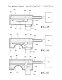 IMPLANTABLE RESTRICTION SYSTEM TENSION RELEASE MECHANISM diagram and image
