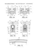 IMPLANTABLE RESTRICTION SYSTEM TENSION RELEASE MECHANISM diagram and image