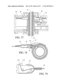 IMPLANTABLE RESTRICTION SYSTEM TENSION RELEASE MECHANISM diagram and image