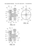 IMPLANTABLE RESTRICTION SYSTEM TENSION RELEASE MECHANISM diagram and image