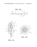 IMPLANTABLE RESTRICTION SYSTEM TENSION RELEASE MECHANISM diagram and image