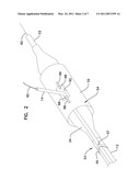 Cutting Member for Bifurcation Catheter Assembly diagram and image