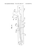 Cutting Member for Bifurcation Catheter Assembly diagram and image