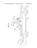 Cutting Member for Bifurcation Catheter Assembly diagram and image