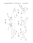 Cutting Member for Bifurcation Catheter Assembly diagram and image