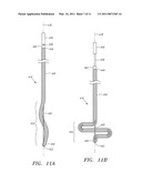 APPARATUS AND METHODS FOR PROVIDING TACTILE FEEDBACK WHILE DELIVERING A CLOSURE DEVICE diagram and image