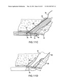 ARTICULATING SUTURING AND DEVICE AND METHOD diagram and image