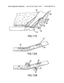 ARTICULATING SUTURING AND DEVICE AND METHOD diagram and image