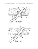 ARTICULATING SUTURING AND DEVICE AND METHOD diagram and image