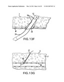 ARTICULATING SUTURING AND DEVICE AND METHOD diagram and image