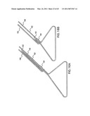 ARTICULATING SUTURING AND DEVICE AND METHOD diagram and image