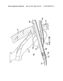 ARTICULATING SUTURING AND DEVICE AND METHOD diagram and image