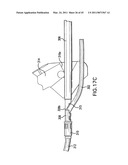 ARTICULATING SUTURING AND DEVICE AND METHOD diagram and image