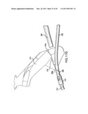 ARTICULATING SUTURING AND DEVICE AND METHOD diagram and image