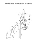 ARTICULATING SUTURING AND DEVICE AND METHOD diagram and image