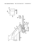 ARTICULATING SUTURING AND DEVICE AND METHOD diagram and image