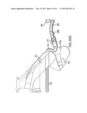 ARTICULATING SUTURING AND DEVICE AND METHOD diagram and image