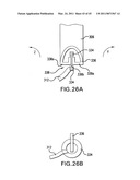 ARTICULATING SUTURING AND DEVICE AND METHOD diagram and image