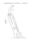 Spinal Rod Insertion Method diagram and image