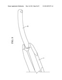 Spinal Rod Insertion Method diagram and image