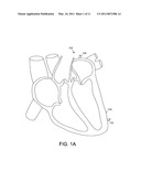 Leadless Cardiac Pacemaker Triggered by Conductive Communication diagram and image