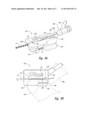 COUPLINGS FOR IMPLANTED LEADS AND EXTERNAL STIMULATORS, AND ASSOCIATED SYSTEMS AND METHODS diagram and image