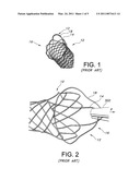 INTEGRATED STENT RETRIEVAL LOOP ADAPTED FOR SNARE REMOVAL AND/OR OPTIMIZED PURSE STRINGING diagram and image